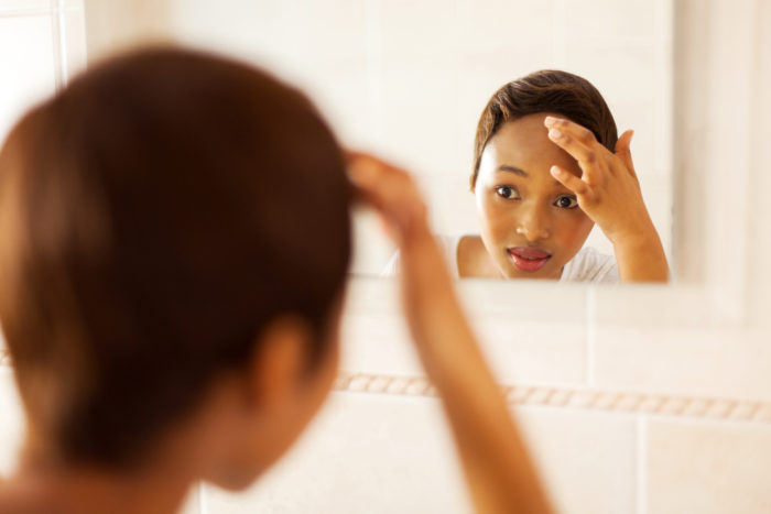 Causes of Adult Acne