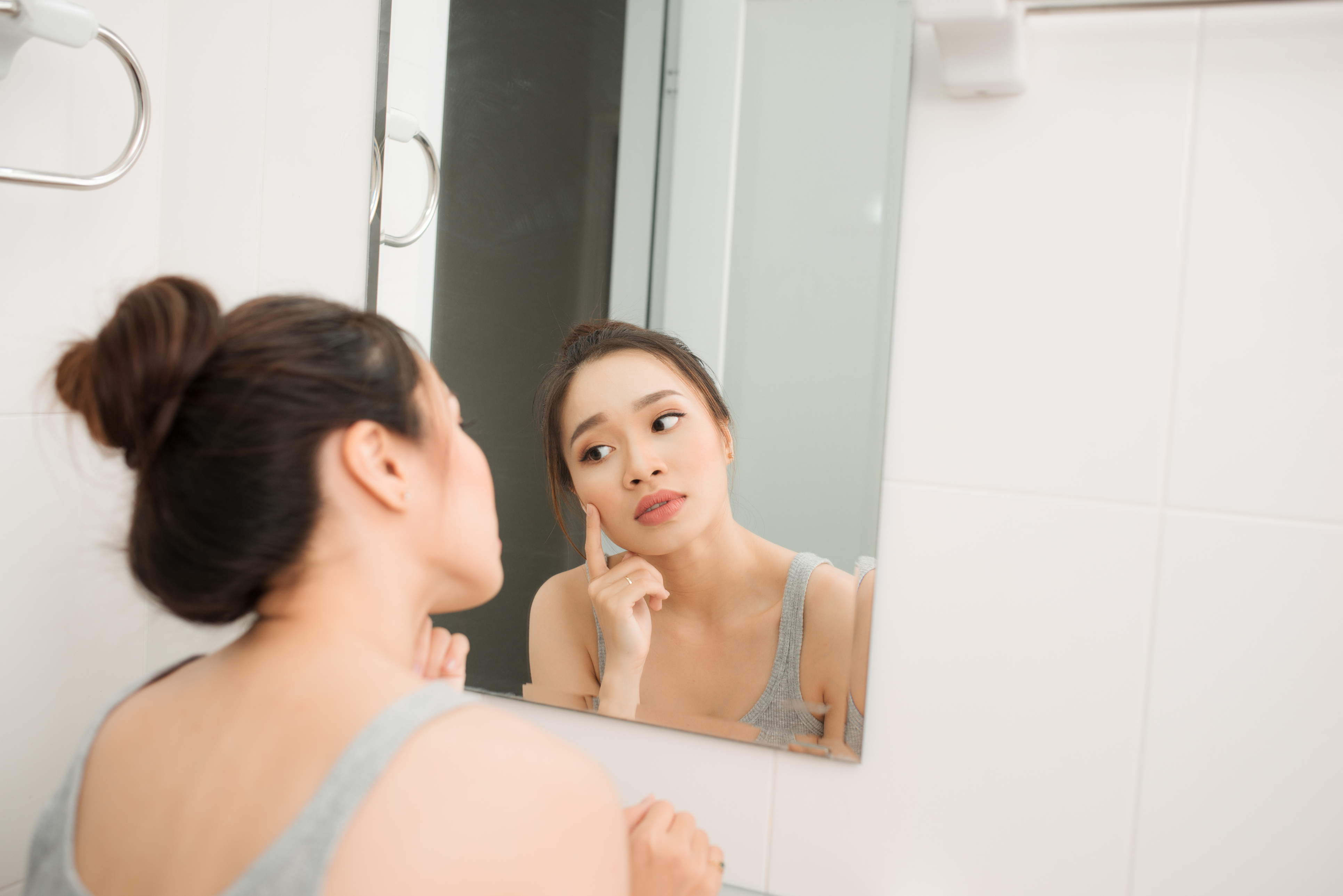 Causes of Adult Acne