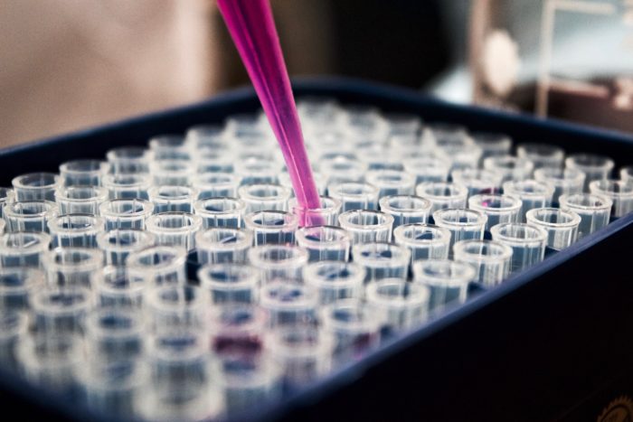 should you take a food sensitivity test